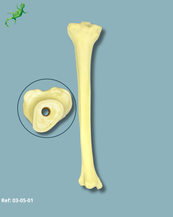 Tibia / Medium / Left / Addi-CORT with intermedullar canal - Ref 03-05-01