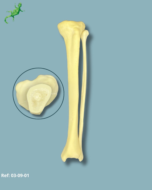 Tibia et Fibula / moyen / Addi-CORT - Ref 03-09-01