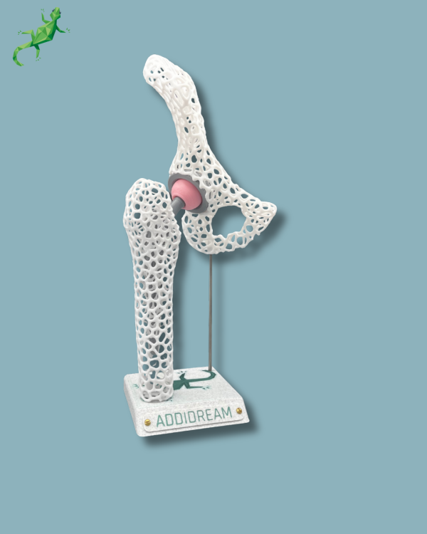 Display Hip Awareness Lattice - Ref 07-AD-01 - Image 6