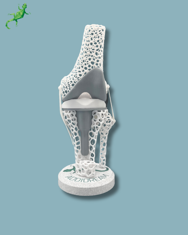 Présentoir Genou Sensibilisation Lattice avec capot - Ref 04-AF-01 – Image 6