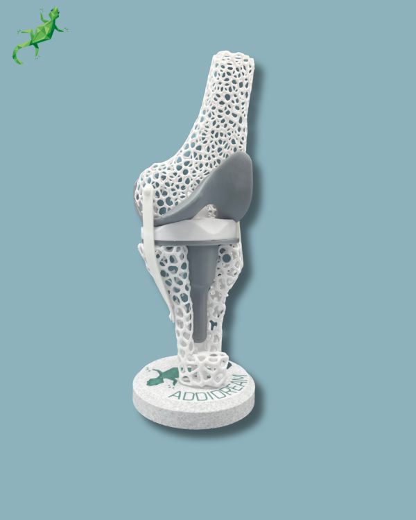 Présentoir Genou Sensibilisation Lattice avec capot - Ref 04-AF-01 – Image 5