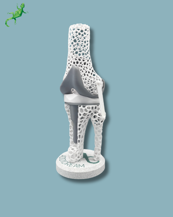 Présentoir Genou Sensibilisation Lattice avec capot - Ref 04-AF-01 – Image 3