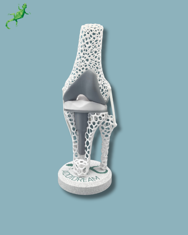 Présentoir Genou Sensibilisation Lattice avec capot - Ref 04-AF-01 – Image 2