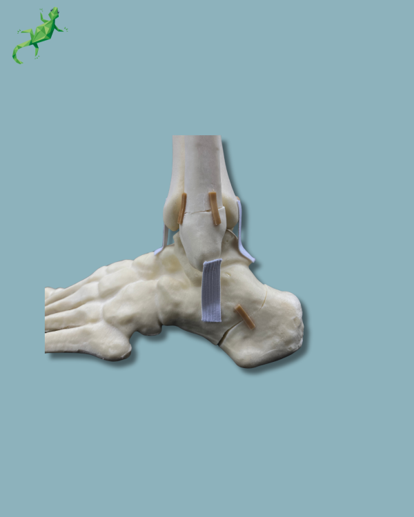 Foot-Ankle and Mid-Tibia and Fibula with fracture / Left / Addi-CAN - Ref 02-22-02 - Image 9