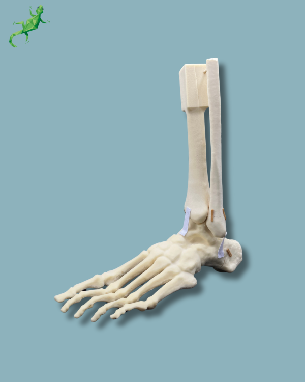 Pied Cheville et Demi-Tibia et Fibula avec fracture / Gauche / Addi-CAN - Ref 02-22-02 – Image 8