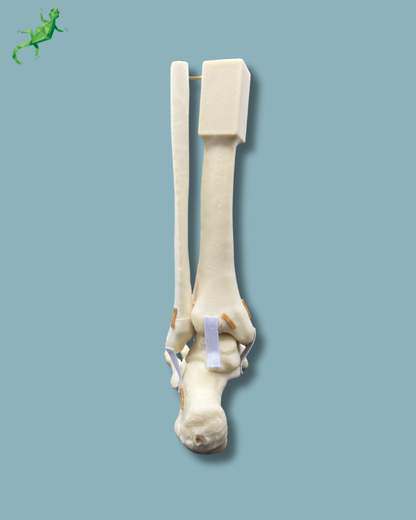 Pied Cheville et Demi-Tibia et Fibula avec fracture / Gauche / Addi-CAN - Ref 02-22-02 – Image 6