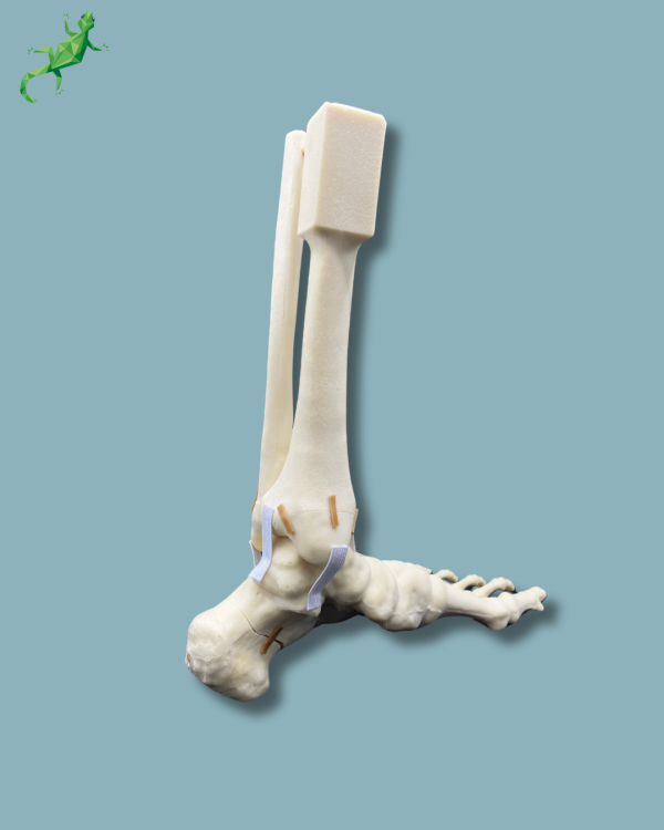 Foot-Ankle and Mid-Tibia and Fibula with fracture / Left / Addi-CAN - Ref 02-22-02 - Image 5