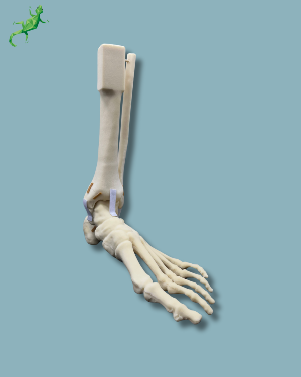 Foot-Ankle and Mid-Tibia and Fibula with fracture / Left / Addi-CAN - Ref 02-22-02 - Image 6
