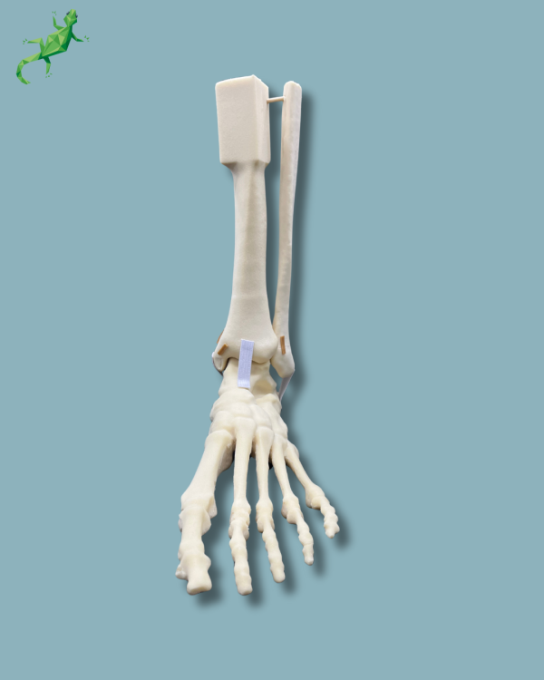 Foot-Ankle and Mid-Tibia and Fibula with fracture / Left / Addi-CAN - Ref 02-22-02 - Image 7