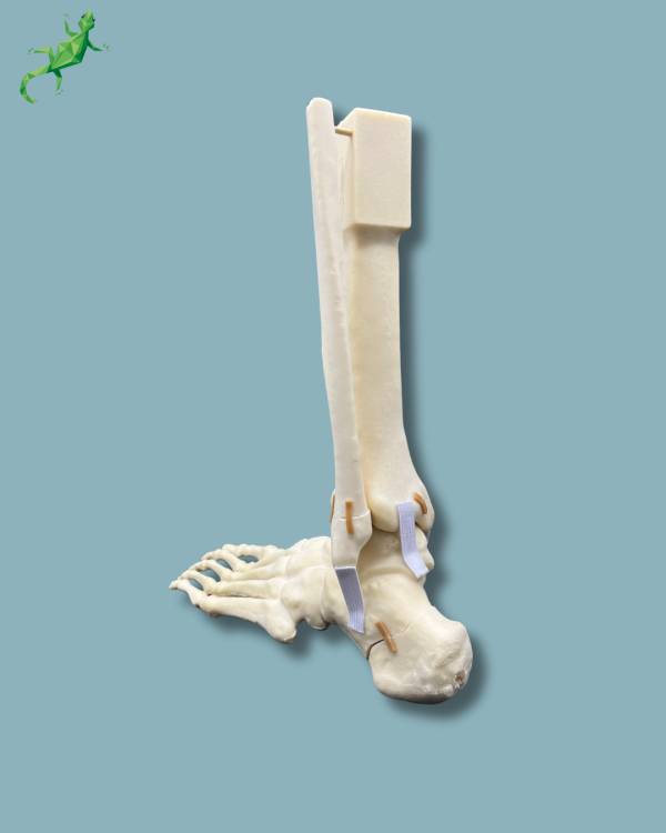 Foot-Ankle and Mid-Tibia and Fibula with fracture / Left / Addi-CAN - Ref 02-22-02 - Image 3