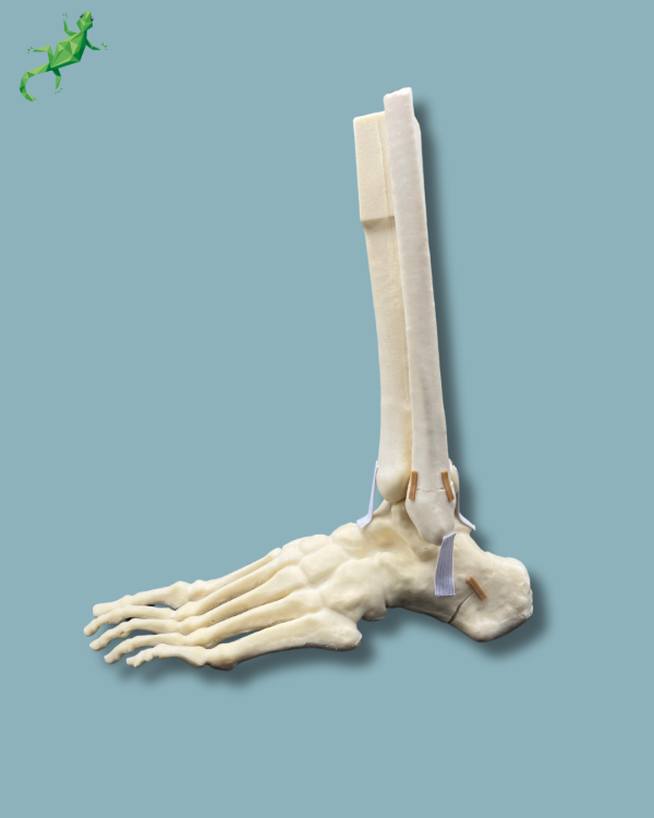 Foot-Ankle and Mid-Tibia and Fibula with fracture / Left / Addi-CAN - Ref 02-22-02 - Image 8