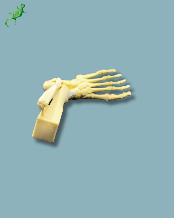 Foot-Ankle and Mid-Tibia and Fibula with fracture / Left / Addi-CAN - Ref 02-22-02 - Image 13