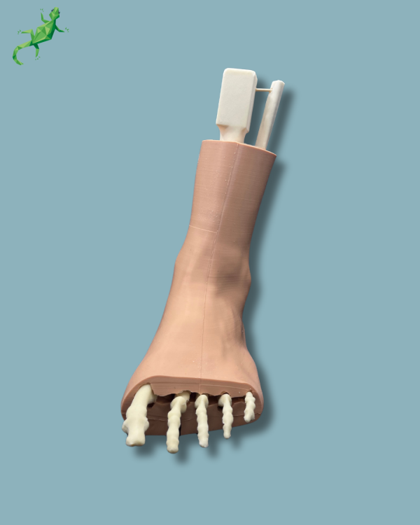 Foot-Ankle and Mid-Tibia Fibula with fracture / Left / Addi-CAN Addi-SKIN - Ref 02-29-02 - Image 8