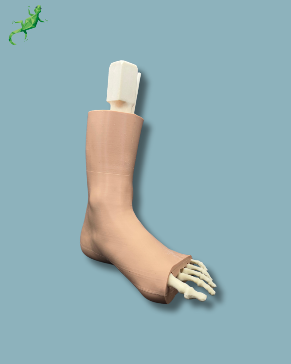 Foot-Ankle and Mid-Tibia Fibula with fracture / Left / Addi-CAN Addi-SKIN - Ref 02-29-02 - Image 9