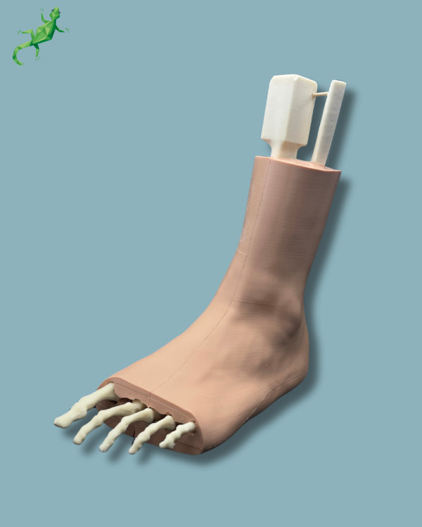 Pied Cheville et Demi-Tibia Fibula avec fracture / Gauche / Addi-CAN Addi-SKIN - Ref 02-29-02