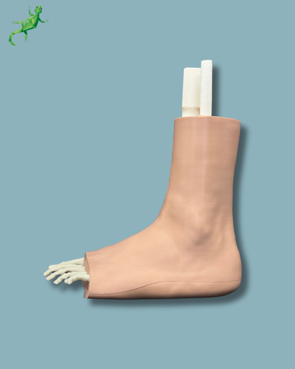 Foot-Ankle and Mid-Tibia Fibula with fracture / Left / Addi-CAN Addi-SKIN - Ref 02-29-02 - Image 7
