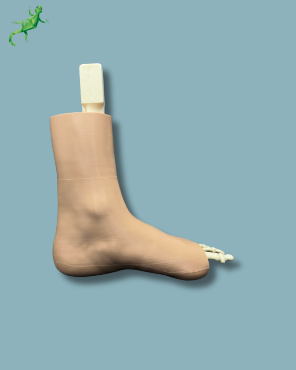 Foot-Ankle and Mid-Tibia Fibula with fracture / Left / Addi-CAN Addi-SKIN - Ref 02-29-02 - Image 3