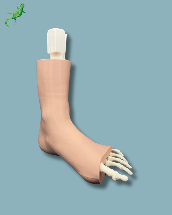 Foot-Ankle and Mid-Tibia Fibula with fracture / Left / Addi-CAN Addi-SKIN - Ref 02-29-02 - Image 2
