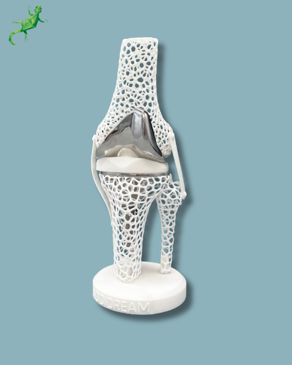 Présentoir Genou Premium Lattice Standard - Ref 04-AJ-01 – Image 2