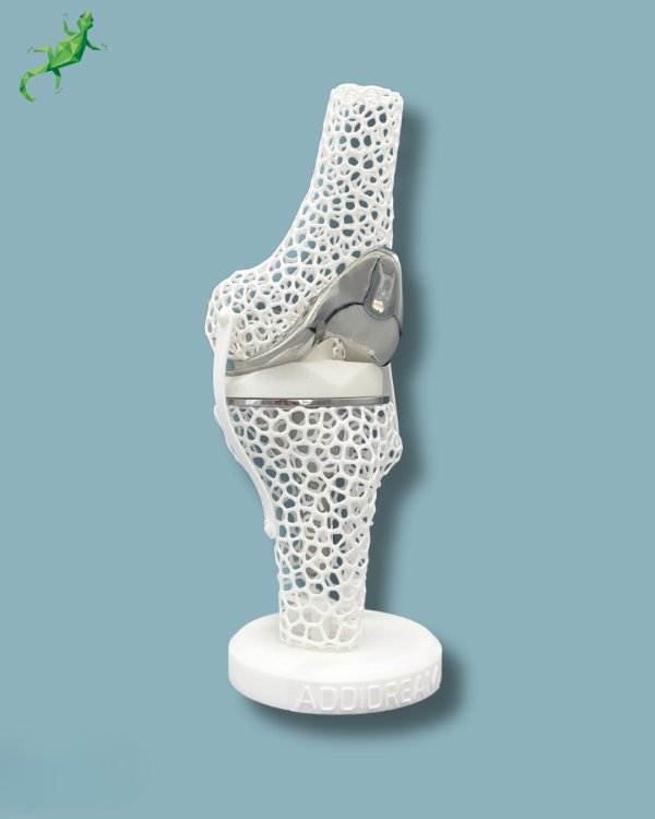 Présentoir Genou Premium Lattice Standard - Ref 04-AJ-01 – Image 9