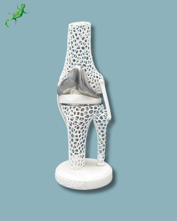 Présentoir Genou Premium Lattice Standard - Ref 04-AJ-01 – Image 3