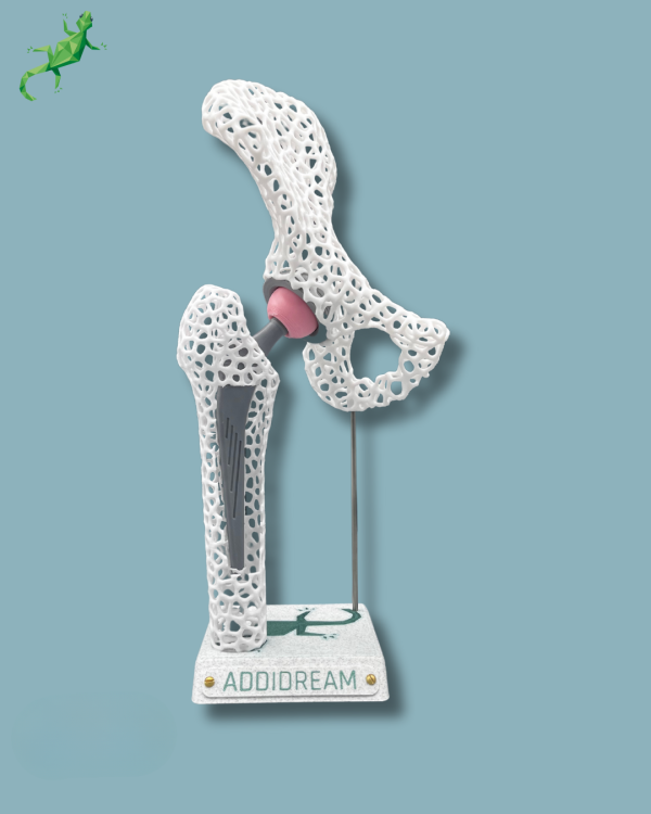 Display Hip Awareness Lattice with window - Ref 07-AE-01