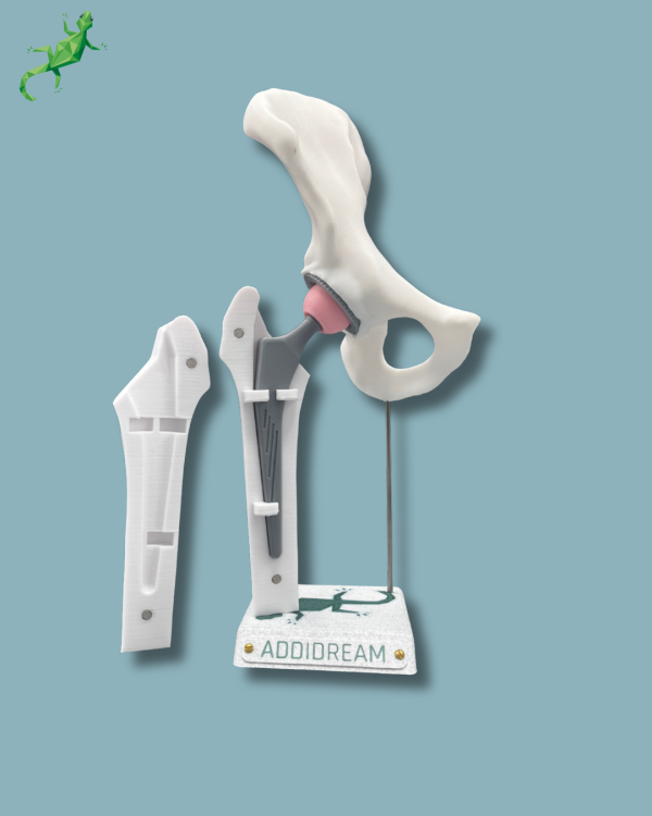 Display Hip Awareness Full with cover - Ref 07-AC-01