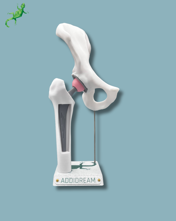 Display Hip Awareness Full with window - Ref 07-AB-01 - Image 6