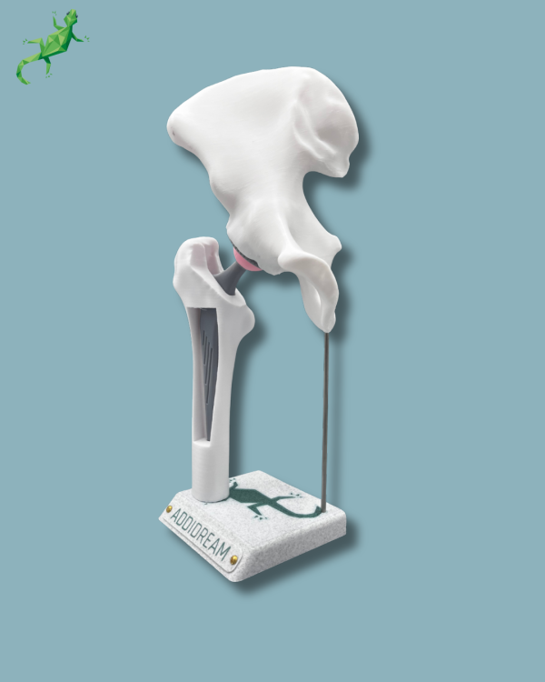 Display Hip Awareness Full with window - Ref 07-AB-01 - Image 3