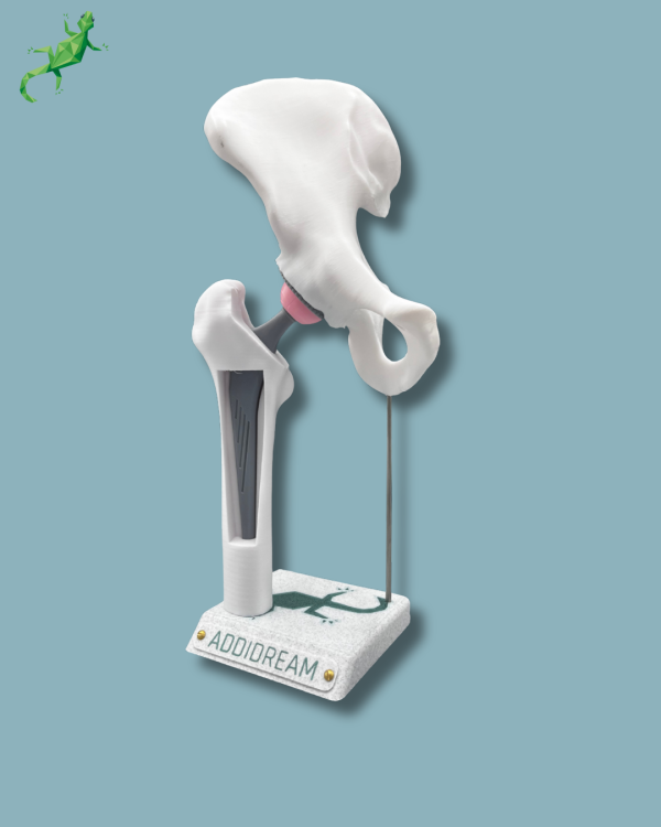 Display Hip Awareness Full with window - Ref 07-AB-01 - Image 2