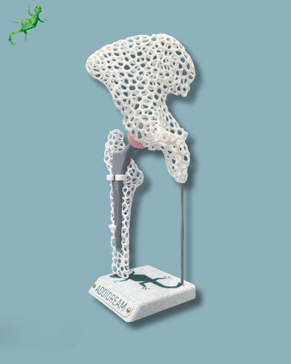 Display Hip Awareness Lattice with cover - Ref 07-AF-01 - Image 6