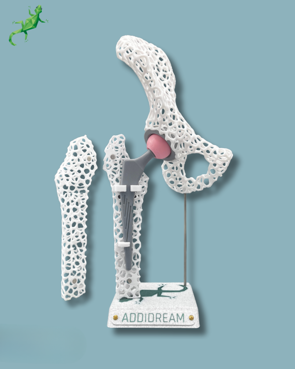 Display Hip Awareness Lattice with cover - Ref 07-AF-01