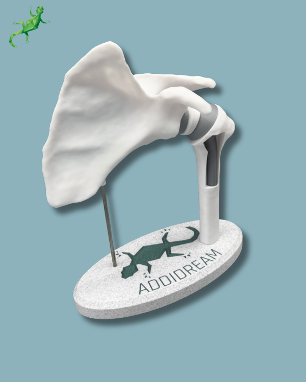 Présentoir Épaule Sensibilisation Plein avec Ouverture - Ref 17-AB-01 – Image 10