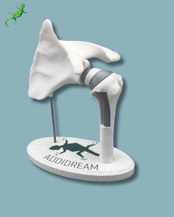 Présentoir Épaule Sensibilisation Plein avec Ouverture - Ref 17-AB-01 – Image 8
