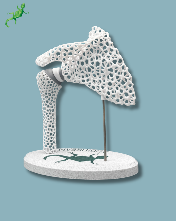 Présentoir Épaule Sensibilisation Lattice - Ref 17-AD-01 – Image 6