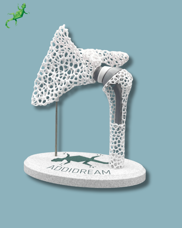 Display Shoulder Awareness Lattice with window - Ref 17-AD-01 - Image 16
