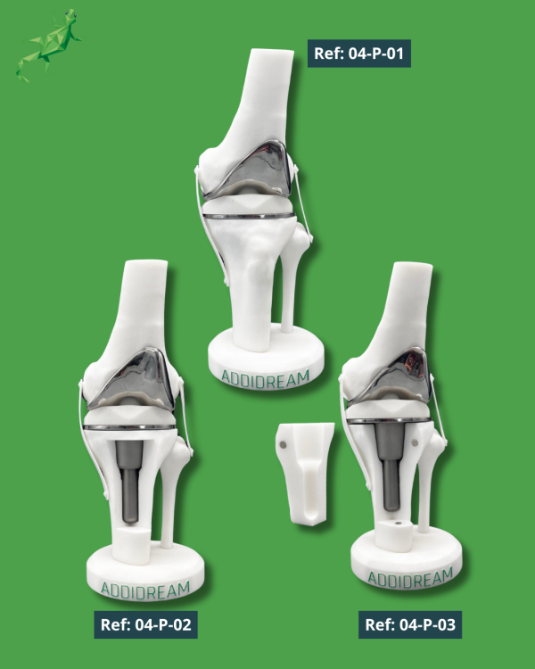 Présentoir Genou Premium - Implants Réel – Image 2