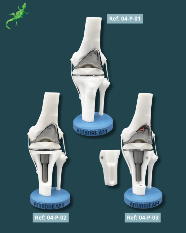 Présentoir Genou Premium - Implants Réel – Image 3