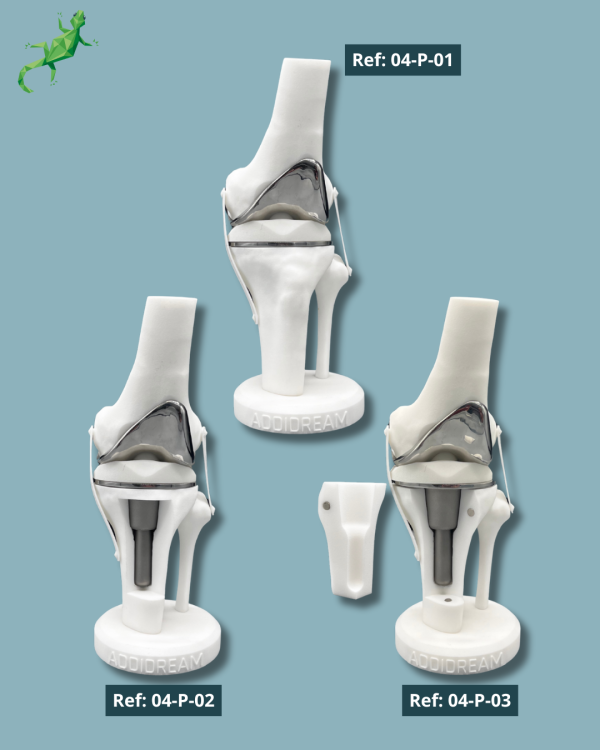 Présentoir Genou Premium - Implants Réel