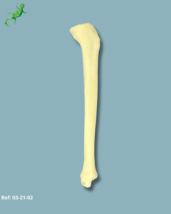 TIBIA / MEDIUM / LEFT / ADDI-CAN with intramedullar canal - Ref 03-21-02 - Image 3