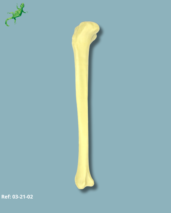 TIBIA / MEDIUM / LEFT / ADDI-CAN with intramedullar canal - Ref 03-21-02 - Image 4