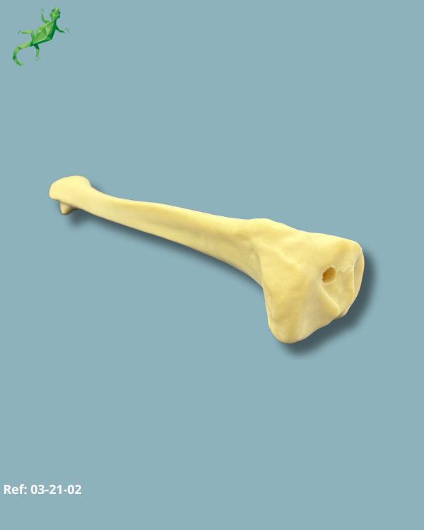 TIBIA / MEDIUM / LEFT / ADDI-CAN with intramedullar canal - Ref 03-21-02 - Image 7