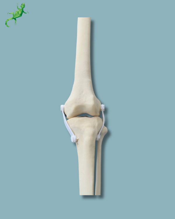 Knee with Fibula / Medium / Left / Addi-CAN - Ref 04-27-01 - Image 6