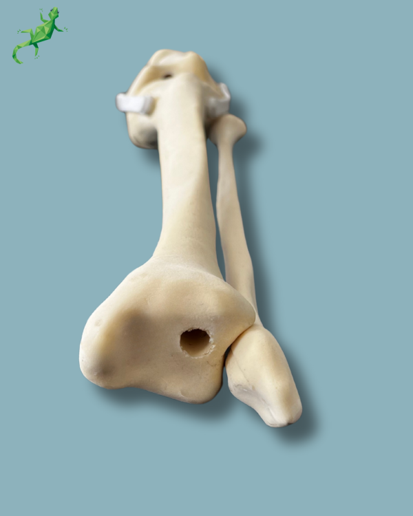 Knee with Fibula / Medium / Left / Addi-CAN with intramedullar canal - Ref 04-30-02 - Image 6