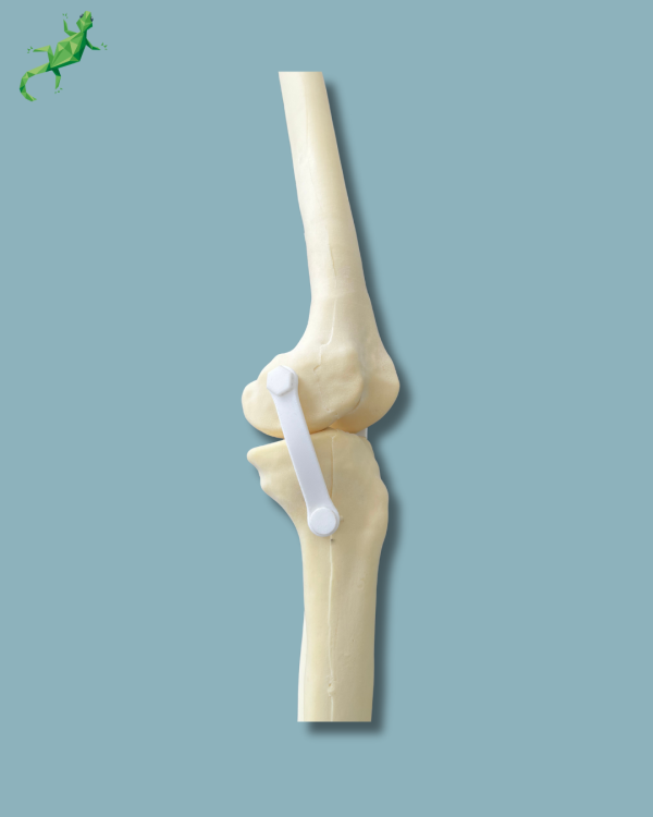 Knee with Fibula / Medium / Left / Addi-CORT with intramedullar canal - Ref 04-29-01 - Image 6