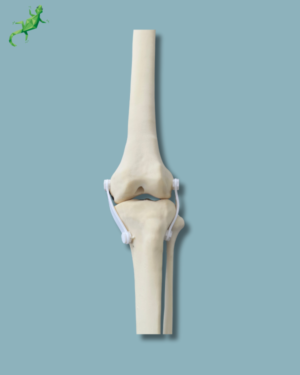 Knee with Fibula / Medium / Left / Addi-CORT with intramedullar canal - Ref 04-29-01 - Image 5