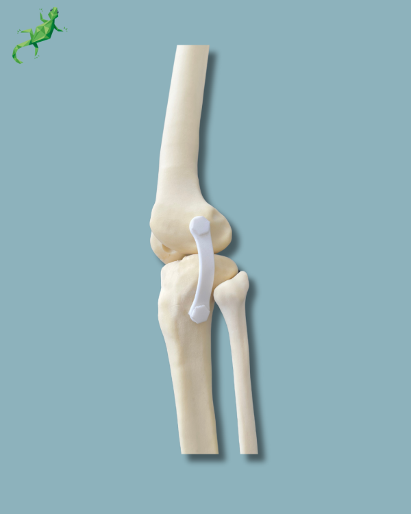 Knee with Fibula / Medium / Left / Addi-CAN with intramedullar canal - Ref 04-30-02 - Image 8