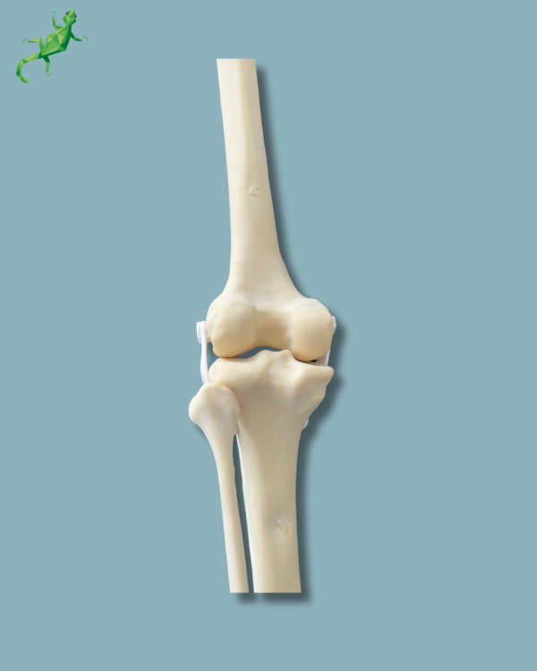 Knee with Fibula / Medium / Left / Addi-CAN with intramedullar canal - Ref 04-30-02 - Image 9
