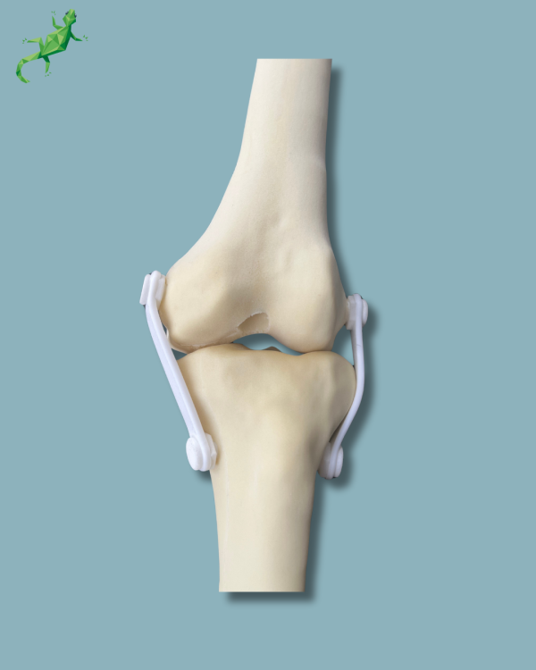 Knee / Medium / Left / Addi-CAN with intramedullar canal - Ref 04-31-01 - Image 8