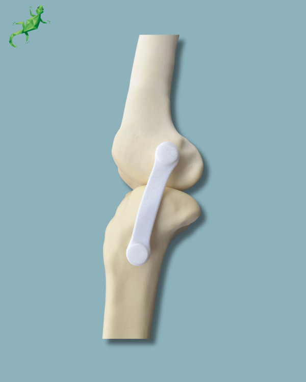 Knee / Medium / Left / Addi-CAN with intramedullar canal - Ref 04-31-01 - Image 9